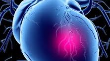 Recurrent Heart Attack And Stroke Nanotherapy